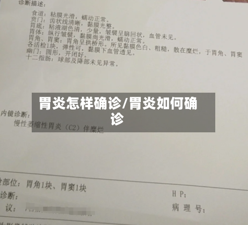 胃炎怎样确诊/胃炎如何确诊-第2张图片
