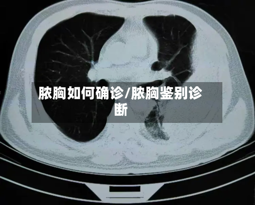 脓胸如何确诊/脓胸鉴别诊断