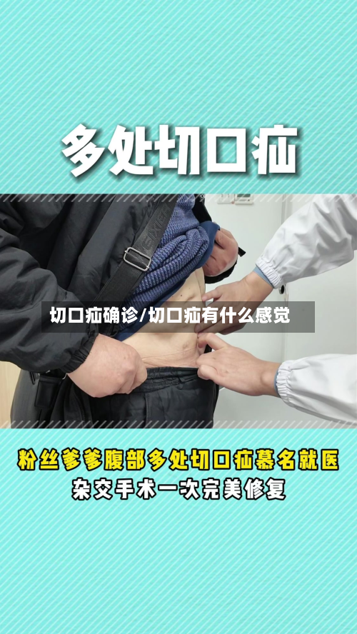 切口疝确诊/切口疝有什么感觉-第2张图片