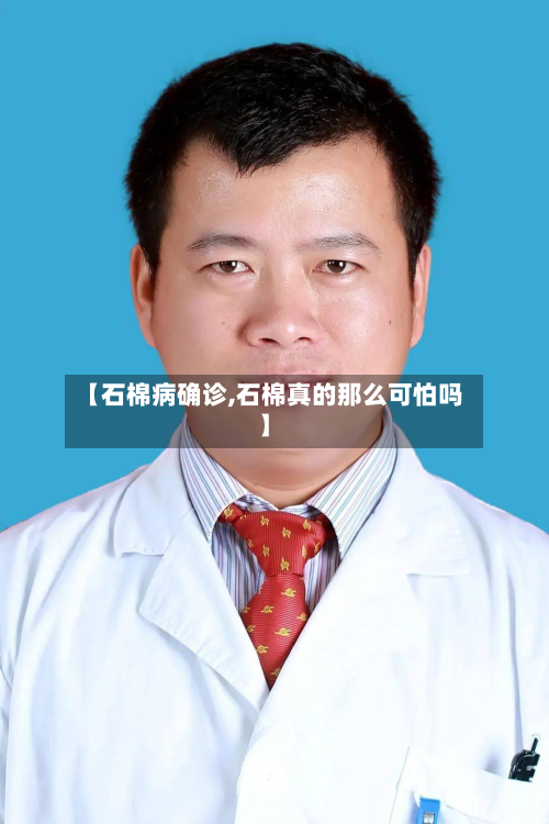 【石棉病确诊,石棉真的那么可怕吗】