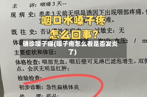 确诊嗓子痛(嗓子疼怎么看是否发炎了)-第2张图片