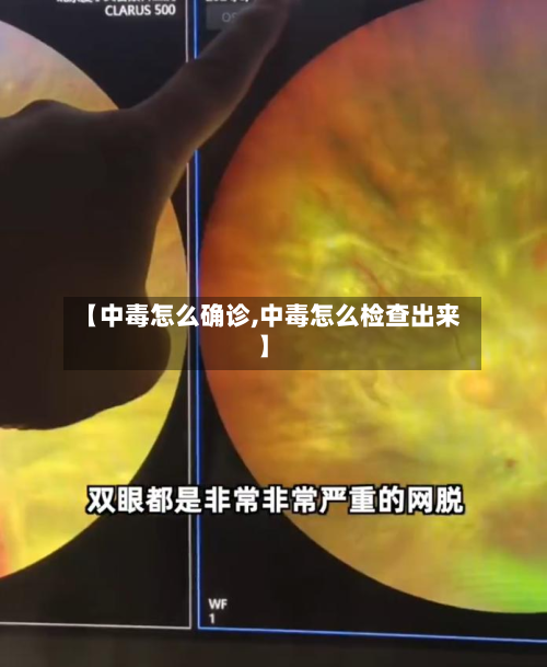 【中毒怎么确诊,中毒怎么检查出来】