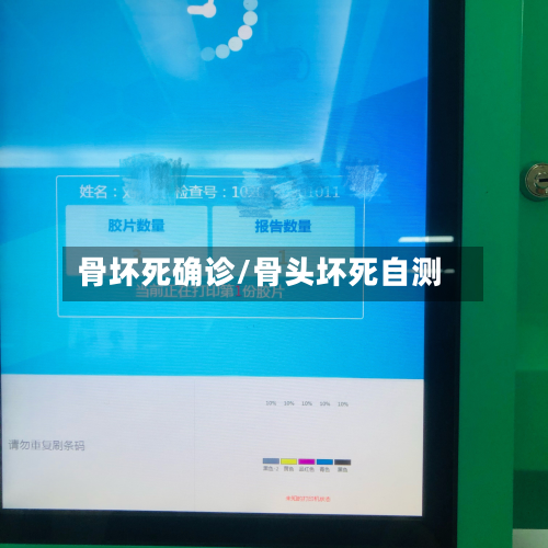 骨坏死确诊/骨头坏死自测-第2张图片