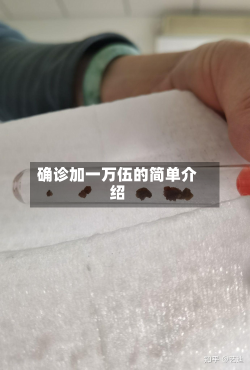 确诊加一万伍的简单介绍-第2张图片