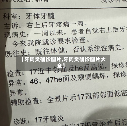 【牙周炎确诊图片,牙周炎确诊图片大全】