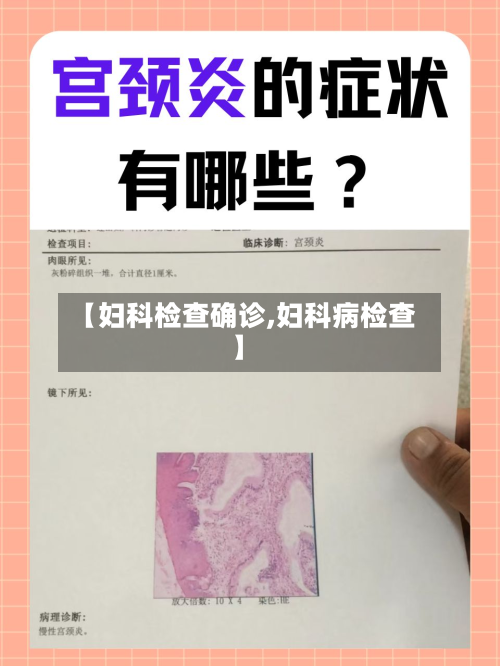 【妇科检查确诊,妇科病检查】