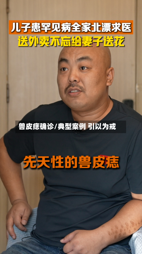 兽皮痣确诊/典型案例 引以为戒-第3张图片