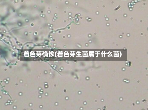 着色芽确诊(着色芽生菌属于什么菌)-第2张图片