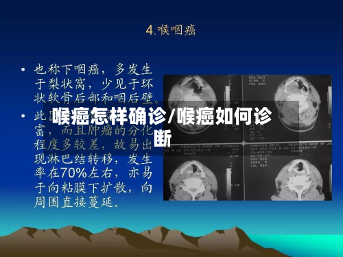 喉癌怎样确诊/喉癌如何诊断