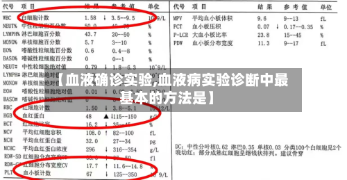 【血液确诊实验,血液病实验诊断中最基本的方法是】-第2张图片