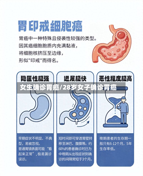女生确诊胃癌/28岁女子确诊胃癌