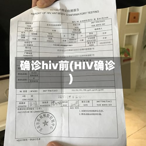 确诊hiv前(HIV确诊)-第2张图片