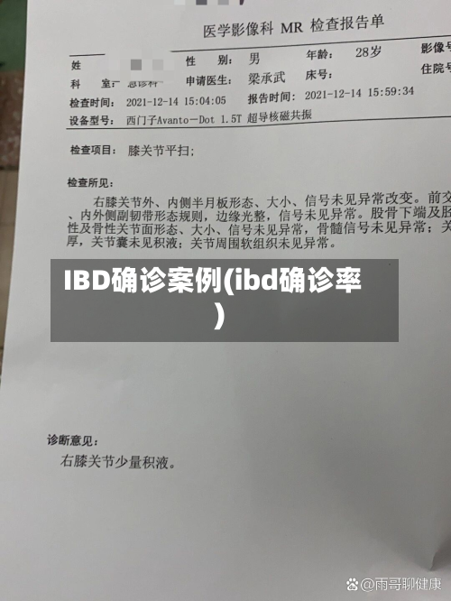 IBD确诊案例(ibd确诊率)