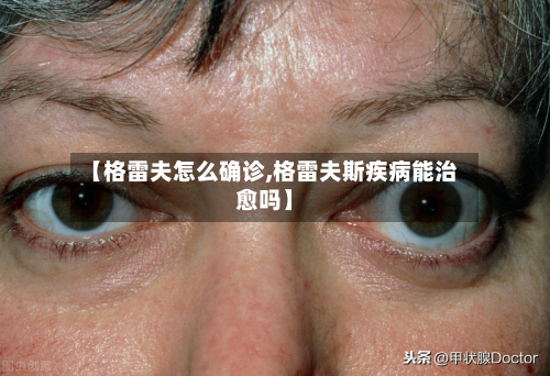 【格雷夫怎么确诊,格雷夫斯疾病能治愈吗】