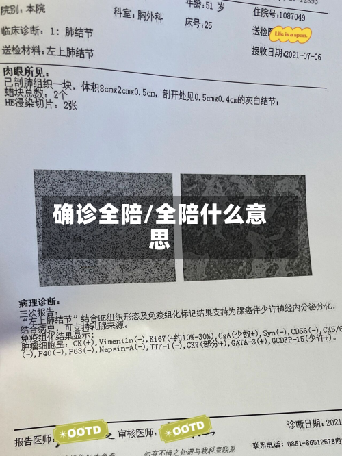 确诊全陪/全陪什么意思