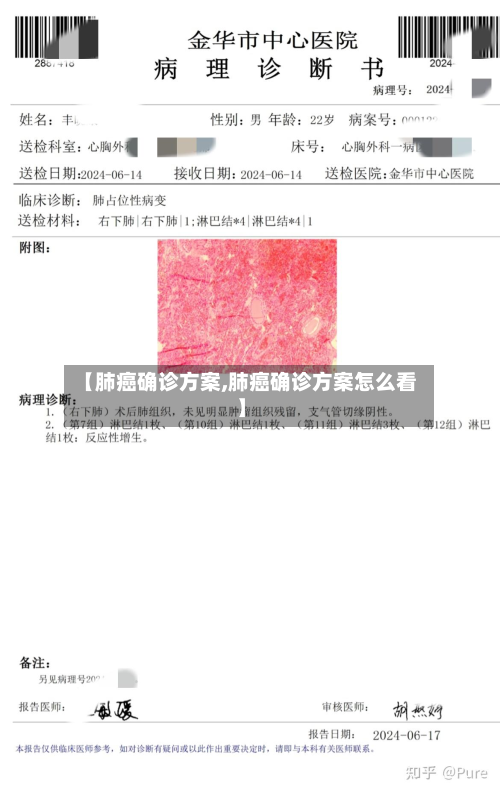 【肺癌确诊方案,肺癌确诊方案怎么看】