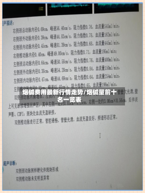 烟碱费用最新行情走势/烟碱量前十名一览表-第2张图片