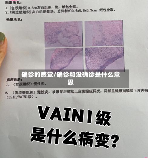 确诊的感觉/确诊和没确诊是什么意思-第2张图片