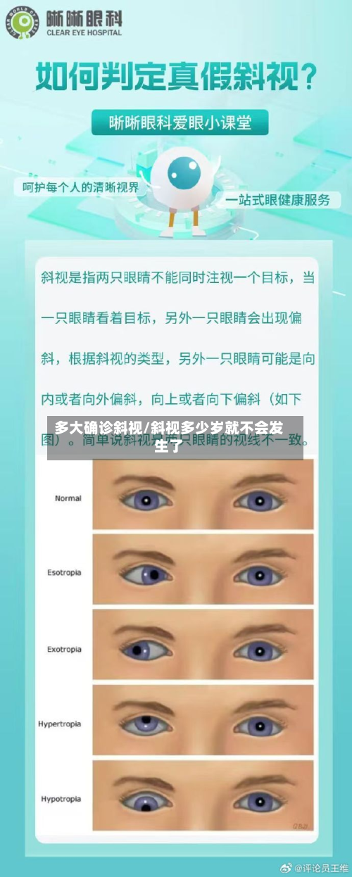 多大确诊斜视/斜视多少岁就不会发生了